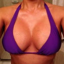 3 weeks post op