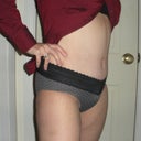 6 weeks po.  You can see my pubic mound..pretty huge.  Still looking like I have a man package!