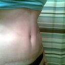 three and one half months-scar is fading!!! :)