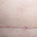 So thin..Wonder what It will look like in few months!