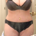 12 days Post Op