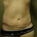 3 Weeks PO