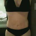Bikini at 3 Weeks PO
