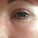 Left eye...doing great!