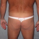 White thong is before