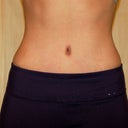 14 weeks PO