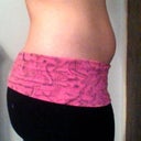 Day after procedure, pretty swollen.