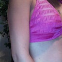 4days after BA bikini top side view