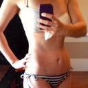 45 days post op