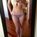 45 days post op