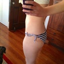 45 days post op. My thigh isn't that large. It's just the angle.