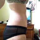 9 days post op