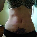 9 days post op