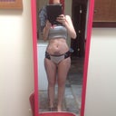 50 hours after surgery :) Took garment off to wash it. This is how I look so far :)