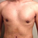 After 2 wks