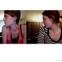 3 1/2 months post-op profile.