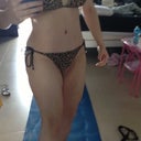 3 months post op. wearing my bikini in public for the first time. I got a lot of compliments. My body is looking good! Belly button is still dark but everything else is beautiful! Even the scar is covered! :)