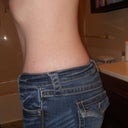 11 weeks post op, can finally wear all my jeans