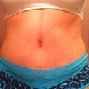 4 weeks PO today.  Not too bad in panties!!