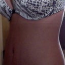 AFTER. DR. SOTO. 2ND WEEK (Notice even side)