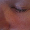 Latisse Day 1 - Img 1