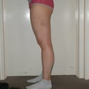 3 weeks after liposuction
