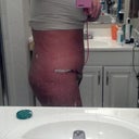 2 days after side