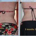 back comparison