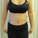 10 Days Post-Op