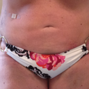 Front view - day 4. The bump on my left side was there before the lipo.