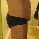 Yuk. Before.