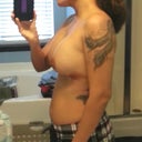 Day 2 Post Op - side view
