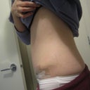 10 DPO - the initial 'girdle' effect keeps you tucked in tight.