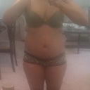 after weight gain for surgery