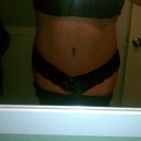 13 weeks post op