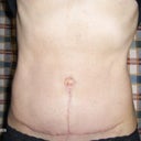 After 8 wks
