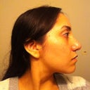 After-4 months