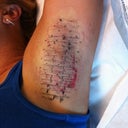 The little x's are where each injection goes.