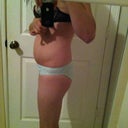before surgery, left side again but different angle