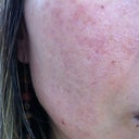 17 days after.