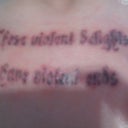 One day after 5th treatment, blisters and all.