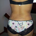5 weeks P/O back