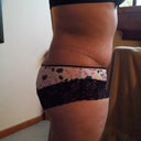 5 weeks P/O side