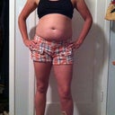 This is what I look like 3 weeks pre-op