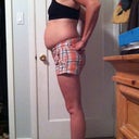 Side view 3 weeks pre-op.  My youngest is 3 yrs old, and I look 5 months pregnant all the time