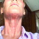 Day 1 Neck