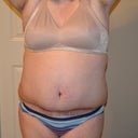 7 wks po front