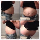 My muscles are incredibly stretched. If I don't suck in... This is what my tummy does. I look pregnant again. Aside from the looks, I can't do a sit up and my legs are numb thanks to the increased pressure on my surgical site of my spinal fusion. My chiro is convinced this will help if not eliminate the pain.