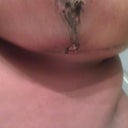this may take awhile to heal. its scabbing pretty bad