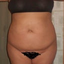 12/01/08 the day before surgery.